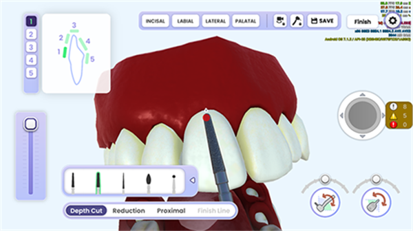 牙医模拟器安卓版截屏1